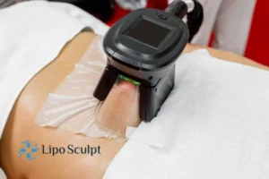Are The Results From Aqualyx Permanent? 4 Compare Aqualyx Middlesex to other fat reduction treatments.