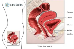 Treatment For A Leaky Bladder 2 How EM Chair treatment Middlesex can help Leaky bladder issues. Read more now!