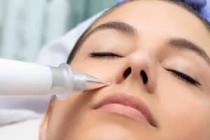 Best Actinic Keratoses Removal 3 Actinic keratoses Middlesex solutions - book in today!