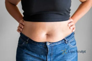 Bidding Farewell to Muffin Tops with Aqualyx Fat Injections 2 Do you wish you could reduce your muffin top Middlesex With Aqualy fat dissolving injections you can!